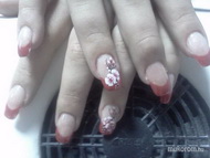 Körömágyhosszabbítás