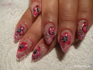 Épített Zselés köröm