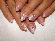 kombinált díszítés