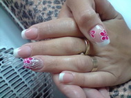 végre hibátlan hálóbeépítés