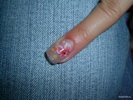 beépített porci virág