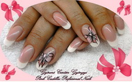 Best Nails - Zitus