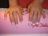 Francia kocka köröm kezdetek