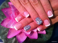 Francia köröm kövekkel