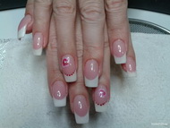 Zselé töltés akrillal díszítve