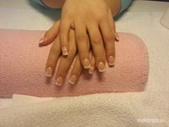 Körömágy hosszabbítás