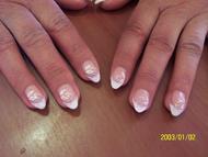 Francia köröm akrillal és csillámmal