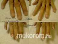 Best Nails - előtte-utána