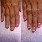 Best Nails - Előtte utána