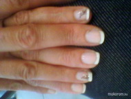 saját köröm erösités