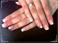 Berninek a szokásos francia