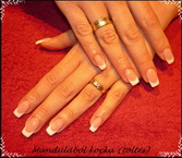 Mandula után ez lett belőle