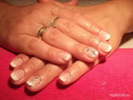 Francia Gel Lac Évinek