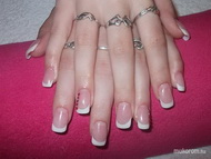 Első fr épített porcim