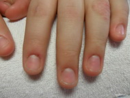 Best Nails - ilyen volt