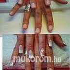 Best Nails - 2008 előtte utána porcelán