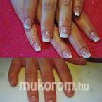 Best Nails - 2008 rágott előtte utána porcelán
