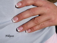 Francia felületi zselével