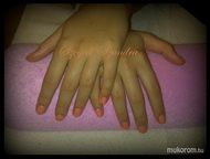 GelLac