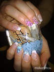 gel lac