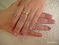 lakkzselé akril mintával