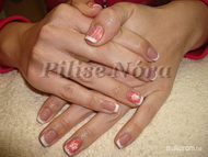 lakkzselé akril mintával