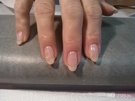 Lakk zselé Esztikének