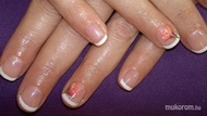 Shellac