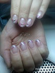 gel lac