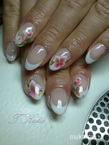 gel lac