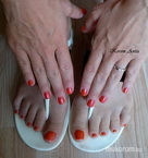 zselés erősítés ézre gl kézre lábra