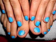 Kékség kézre lábra