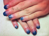 Lenövésmentes gél lakk