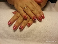 Fekete akril mintával