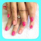 Töltésre gél lakk