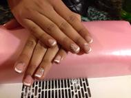 francia géllak kővel