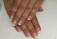 Francia géllakkozás