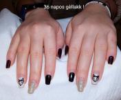36 napos géllakk