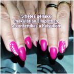 5 hetes géllakk