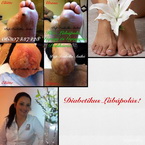 Én és a diabéteszes lábak