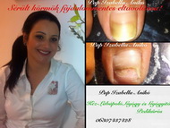 Én és a sérült körmök