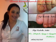 Én és a benőtt körmök