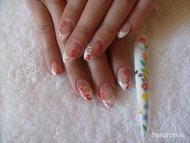 Mezőkövesdi köröm és Kalocsai medál