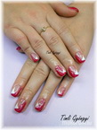 Nettinek