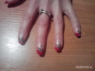 anikó rózsaszínje