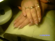 kombinalt mukorom diszites