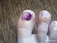 Best Nails - Toe nail decoration