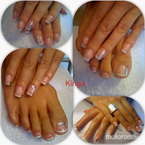 Francia kövekkel kézre lábra