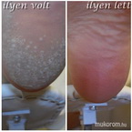 peikűr ilyen volt ilyen lett