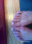 Best Nails - ilyen lett pedigéllel antifungálos